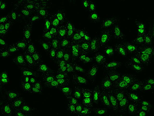 PPP4R2 Antibody - Immunofluorescence staining of PPP4R2 in U2OS cells. Cells were fixed with 4% PFA, permeabilzed with 0.1% Triton X-100 in PBS, blocked with 10% serum, and incubated with rabbit anti-human PPP4R2 polyclonal antibody (dilution ratio 1:1000) at 4°C overnight. Then cells were stained with the Alexa Fluor 488-conjugated Goat Anti-rabbit IgG secondary antibody (green). Positive staining was localized to Nucleus.