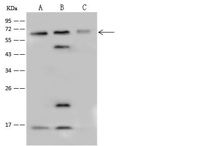 PPP4R2 Antibody - Anti-PPP4R2 rabbit polyclonal antibody at 1:500 dilution. Lane A: Jurkat Whole Cell Lysate. Lane B: HeLa Whole Cell Lysate. Lane C: 293T Whole Cell Lysate. Lysates/proteins at 30 ug per lane. Secondary: Goat Anti-Rabbit IgG (H+L)/HRP at 1/10000 dilution. Developed using the ECL technique. Performed under reducing conditions. Predicted band size: 47 kDa.