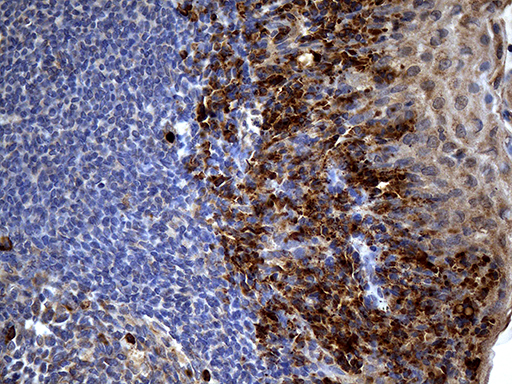 PPP4R4 Antibody - Immunohistochemical staining of paraffin-embedded Human tonsil within the normal limits using anti-PPP4R4 mouse monoclonal antibody. (Heat-induced epitope retrieval by 1mM EDTA in 10mM Tris buffer. (pH8.5) at 120°C for 3 min. (1:500)
