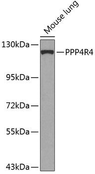 PPP4R4 Antibody - Western blot analysis of extracts of mouse lung using PPP4R4 Polyclonal Antibody at dilution of 1:1000.