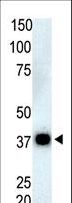 PPP5C Antibody - The anti-PPP6C antibody is used in Western blot to detect PPP6C in Thymus cell lysate.