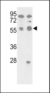 PPP5C Antibody - Western blot of hPPP5C-N61 in A375, A2058 cell line lysates (35 ug/lane). PPP5C (arrow) was detected using the purified antibody.