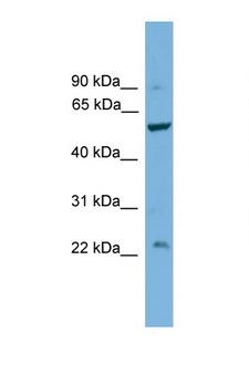 PPP5C Antibody - PPP5C antibody Western blot of COL0205 Cell lysate. Antibody concentration 1 ug/ml. This image was taken for the unconjugated form of this product. Other forms have not been tested.