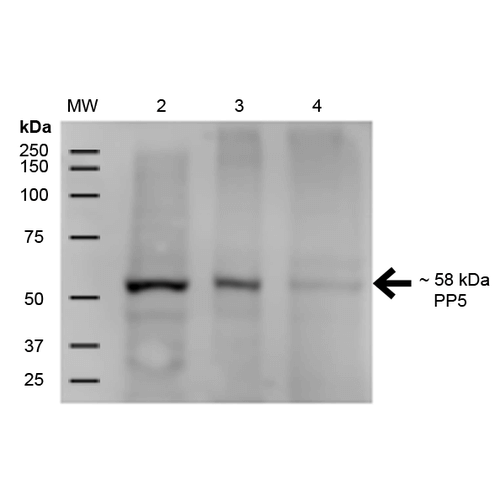 PPP5C Antibody - Western Blot analysis of Human A431, HEK293, and Jurkat cell lysates showing detection of ~58 kDa PP5 protein using Mouse Anti-PP5 Monoclonal Antibody, Clone 12F7. Lane 1: MW Ladder. Lane 2: Human A431 (15 µg). Lane 3: Human HEK293 (15 µg). Lane 4: Human Jurkat (15 µg). Load: 15 µg. Block: 5% Skim Milk for 1 hour at RT. Primary Antibody: Mouse Anti-PP5 Monoclonal Antibody  at 1:500 for 1 hour at RT. Secondary Antibody: Goat Anti-Mouse IgG: HRP at 1:200 for 1 hour at RT. Color Development: ECL solution for 6 min at RT. Predicted/Observed Size: ~58 kDa.