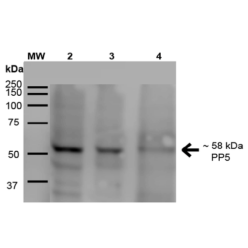 PPP5C Antibody - Western Blot analysis of Human A431, HEK293, and Jurkat cell lysates showing detection of ~58 kDa PP5 protein using Mouse Anti-PP5 Monoclonal Antibody, Clone 2E11. Lane 1: MW Ladder. Lane 2: Human A431 (15 µg). Lane 3: Human HEK293 (15 µg). Lane 4: Human Jurkat (15 µg). Load: 15 µg. Block: 5% Skim Milk for 1 hour at RT. Primary Antibody: Mouse Anti-PP5 Monoclonal Antibody  at 1:500 for 1 hour at RT. Secondary Antibody: Goat Anti-Mouse IgG: HRP at 1:200 for 1 hour at RT. Color Development: ECL solution for 6 min at RT. Predicted/Observed Size: ~58 kDa.