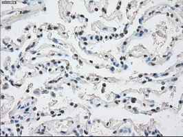 PPP5C Antibody - IHC of paraffin-embedded lung tissue using anti-PPP5C mouse monoclonal antibody. (Dilution 1:50).
