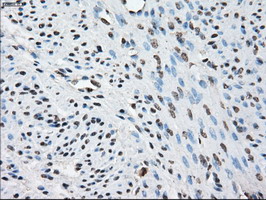 PPP5C Antibody - IHC of paraffin-embedded endometrium tissue using anti-PPP5C mouse monoclonal antibody. (Dilution 1:50).