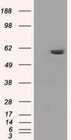PPP5C Antibody - HEK293T cells were transfected with the pCMV6-ENTRY control (Left lane) or pCMV6-ENTRY PPP5C (Right lane) cDNA for 48 hrs and lysed. Equivalent amounts of cell lysates (5 ug per lane) were separated by SDS-PAGE and immunoblotted with anti-PPP5C.