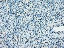 PPP5C Antibody - Immunohistochemical staining of paraffin-embedded Human Ovary tissue using anti-PPP5C mouse monoclonal antibody.