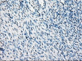 PPP5C Antibody - Immunohistochemical staining of paraffin-embedded Ovary tissue using anti-PPP5C mouse monoclonal antibody. (Dilution 1:50).