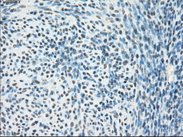 PPP5C Antibody - Immunohistochemical staining of paraffin-embedded endometrium tissue using anti-PPP5C mouse monoclonal antibody. (Dilution 1:50).