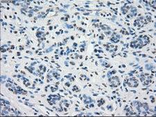 PPP5C Antibody - Immunohistochemical staining of paraffin-embedded breast tissue using anti-PPP5C mouse monoclonal antibody. (Dilution 1:50).