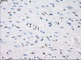 PPP5C Antibody - Immunohistochemical staining of paraffin-embedded colon tissue using anti-PPP5C mouse monoclonal antibody. (Dilution 1:50).