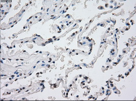 PPP5C Antibody - Immunohistochemical staining of paraffin-embedded lung tissue using anti-PPP5C mouse monoclonal antibody. (Dilution 1:50).