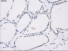 PPP5C Antibody - Immunohistochemical staining of paraffin-embedded thyroid tissue using anti-PPP5C mouse monoclonal antibody. (Dilution 1:50).