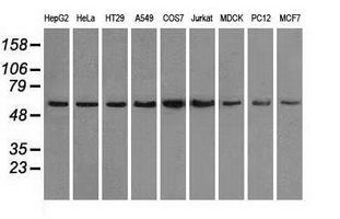 PPP5C Antibody - Western blot of extracts (35 ug) from 9 different cell lines by using anti-PPP5C monoclonal antibody.