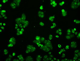 PPP5C Antibody - Immunofluorescent staining of HT29 cells using anti-PPP5C mouse monoclonal antibody.