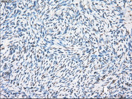 PPP5C Antibody - IHC of paraffin-embedded Ovary tissue using anti-PPP5C mouse monoclonal antibody. (Dilution 1:50).