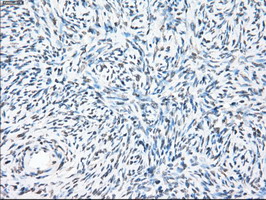 PPP5C Antibody - IHC of paraffin-embedded Ovary tissue using anti-PPP5C mouse monoclonal antibody. (Dilution 1:50).