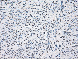 PPP5C Antibody - IHC of paraffin-embedded endometrium tissue using anti-PPP5C mouse monoclonal antibody. (Dilution 1:50).