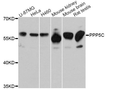 PPP5C Antibody - Western blot analysis of extracts of various cell lines, using PPP5C Antibody at 1:3000 dilution. The secondary antibody used was an HRP Goat Anti-Rabbit IgG (H+L) at 1:10000 dilution. Lysates were loaded 25ug per lane and 3% nonfat dry milk in TBST was used for blocking. An ECL Kit was used for detection and the exposure time was 60s.