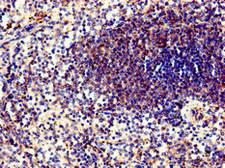 PPP6C Antibody - Immunohistochemistry of paraffin-embedded human spleen tissue at dilution of 1:100