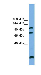 PPP6R1 / SAPS1 Antibody - PPP6R1 / SAPS1 antibody Western blot of RPMI-8226 cell lysate. This image was taken for the unconjugated form of this product. Other forms have not been tested.