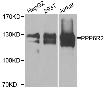 PPP6R2 / SAPS2 Antibody - Western blot analysis of extracts of various cell lines.