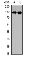 PPP6R2 / SAPS2 Antibody - Western blot analysis of PPP6R2 expression in HepG2 (A); Jurkat (B) whole cell lysates.