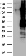 PPP6R2 / SAPS2 Antibody - HEK293T cells were transfected with the pCMV6-ENTRY control. (Left lane) or pCMV6-ENTRY SAPS2(PPP6R2). (Right lane) cDNA for 48 hrs and lysed