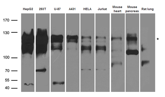 PPP6R2 / SAPS2 Antibody - Western blot analysis of extracts. (35ug) from different cell lines and tissues by using anti-SAPS2(PPP6R2) rabbit polyclonal antibody.