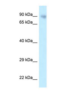 PPP6R3 / SAPS3 Antibody - PPP6R3 / SAPS3 antibody Western blot of 721_B Cell lysate. Antibody concentration 1 ug/ml.  This image was taken for the unconjugated form of this product. Other forms have not been tested.