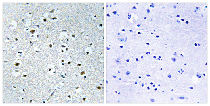 PPRC1 Antibody - Immunohistochemistry analysis of paraffin-embedded human brain tissue, using PPRC1 Antibody. The picture on the right is blocked with the synthesized peptide.