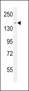 PPRC1 Antibody - PPRC1 Antibody western blot of Jurkat cell line lysates (35 ug/lane). The PPRC1 antibody detected the PPRC1 protein (arrow).