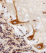 PPT1 / CLN1 Antibody - Immunohistochemical of paraffin-embedded H. cerebellum section using PPT1 Antibody. Antibody was diluted at 1:25 dilution. A peroxidase-conjugated goat anti-rabbit IgG at 1:400 dilution was used as the secondary antibody, followed by DAB staining.
