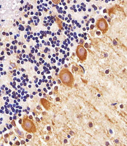 PPT1 / CLN1 Antibody - Immunohistochemical of paraffin-embedded M. cerebellum section using PPT1 Antibody. Antibody was diluted at 1:25 dilution. A peroxidase-conjugated goat anti-rabbit IgG at 1:400 dilution was used as the secondary antibody, followed by DAB staining.