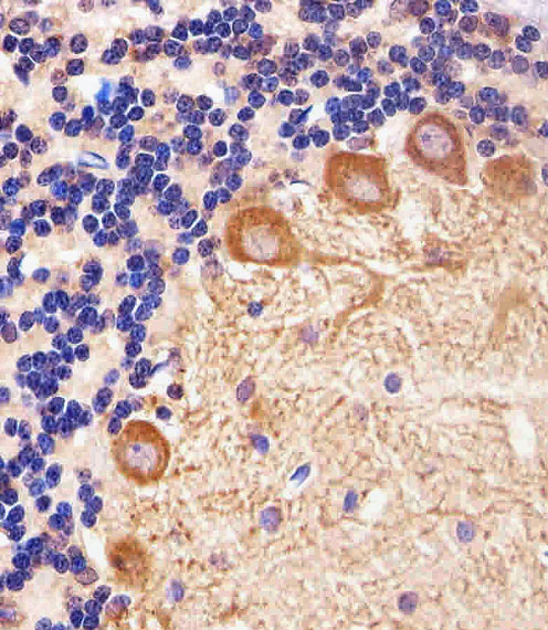 PPT1 / CLN1 Antibody - Immunohistochemical of paraffin-embedded R. cerebellum section using PPT1 Antibody. Antibody was diluted at 1:25 dilution. A peroxidase-conjugated goat anti-rabbit IgG at 1:400 dilution was used as the secondary antibody, followed by DAB staining.