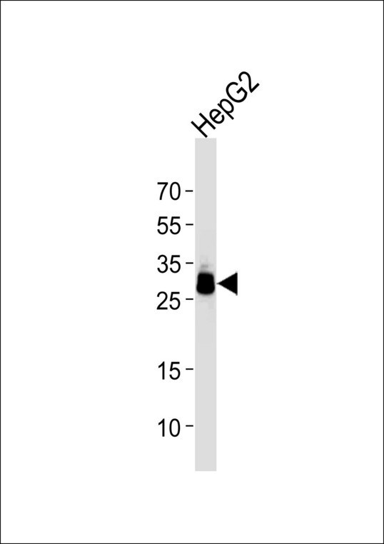 PPT1 / CLN1 Antibody - Western blot of lysate from HepG2 cell line using PPT1 Antibody. Antibody was diluted at 1:1000 at each lane. A goat anti-mouse IgG H&L (HRP) at 1:3000 dilution was used as the secondary antibody. Lysate at 35 ug per lane.