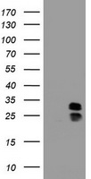 PPT1 / CLN1 Antibody - HEK293T cells were transfected with the pCMV6-ENTRY control (Left lane) or pCMV6-ENTRY PPT1 (Right lane) cDNA for 48 hrs and lysed. Equivalent amounts of cell lysates (5 ug per lane) were separated by SDS-PAGE and immunoblotted with anti-PPT1.