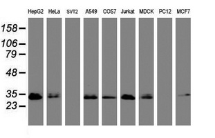 PPT1 / CLN1 Antibody - Western blot of extracts (35 ug) from 9 different cell lines by using anti-PPT1 monoclonal antibody (HepG2: human; HeLa: human; SVT2: mouse; A549: human; COS7: monkey; Jurkat: human; MDCK: canine; PC12: rat; MCF7: human).
