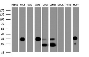 PPT1 / CLN1 Antibody - Western blot of extracts (35 ug) from 9 different cell lines by using g anti-PPT1 monoclonal antibody (HepG2: human; HeLa: human; SVT2: mouse; A549: human; COS7: monkey; Jurkat: human; MDCK: canine; PC12: rat; MCF7: human).