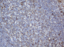 PPT1 / CLN1 Antibody - IHC of paraffin-embedded Human lymph node tissue using anti-PPT1 mouse monoclonal antibody.