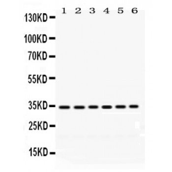 PPT1 / CLN1 Antibody - PPT1 antibody Western blot. All lanes: Anti PPT1 at 0.5 ug/ml. Lane 1: Rat Brain Tissue Lysate at 50 ug. Lane 2: Rat Liver Tissue Lysate at 50 ug. Lane 3: 22RV1 Whole Cell Lysate at 40 ug. Lane 4: HELA Whole Cell Lysate at 40 ug. Lane 5: A431 Whole Cell Lysate at 40 ug. Lane 6: SMMC Whole Cell Lysate at 40 ug. Predicted band size: 34 kD. Observed band size: 34 kD.