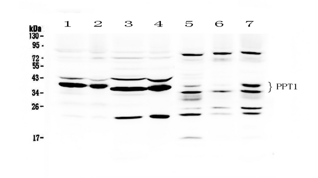PPT1 / CLN1 Antibody - Western blot analysis of PPT1 using anti-PPT1 antibody. Electrophoresis was performed on a 5-20% SDS-PAGE gel at 70V (Stacking gel) / 90V (Resolving gel) for 2-3 hours. The sample well of each lane was loaded with 50ug of sample under reducing conditions. Lane 1: rat brain tissue lysates, Lane 2: mouse brain tissue lysates, Lane 3: rat liver tissue lysates, Lane 4: mouse liver tissue lysates, Lane 5: HEPG2 whole Cell lysates, Lane 6: 293T whole cell lysates, Lane 7: MCF-7 whole cell lysates. After Electrophoresis, proteins were transferred to a Nitrocellulose membrane at 150mA for 50-90 minutes. Blocked the membrane with 5% Non-fat Milk/ TBS for 1.5 hour at RT. The membrane was incubated with rabbit anti-PPT1 antigen affinity purified polyclonal antibody at 0.5 µg/mL overnight at 4°C, then washed with TBS-0.1% Tween 3 times with 5 minutes each and probed with a goat anti-rabbit IgG-HRP secondary antibody at a dilution of 1:10000 for 1.5 hour at RT. The signal is developed using an Enhanced Chemiluminescent detection (ECL) kit with Tanon 5200 system. A specific band was detected for PPT1.