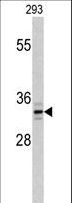 PPT1 / CLN1 Antibody - Western blot of PPT1 Antibody in 293 cell line lysates (35 ug/lane). PPT1 (arrow) was detected using the purified antibody.