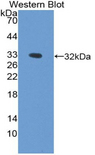 PPT1 / CLN1 Antibody - Western blot of recombinant PPT1 / PPT.