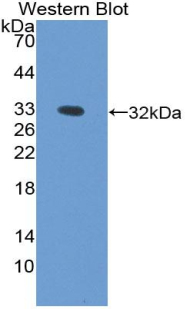 PPT1 / CLN1 Antibody - Western blot of recombinant PPT1 / PPT.