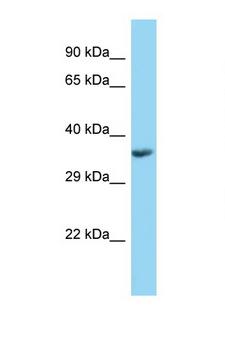 PPT1 / CLN1 Antibody - PPT1 antibody Western blot of Fetal Kidney lysate. Antibody concentration 1 ug/ml.  This image was taken for the unconjugated form of this product. Other forms have not been tested.