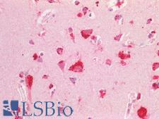 PPT1 / CLN1 Antibody - Human Brain, Cortex Lysosomal Staining: Formalin-Fixed, Paraffin-Embedded (FFPE)