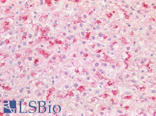 PPT1 / CLN1 Antibody - Human Liver Lysosomal Staining: Formalin-Fixed, Paraffin-Embedded (FFPE)